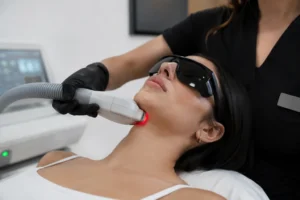 Laser double chin removal and jawline contouring treatment