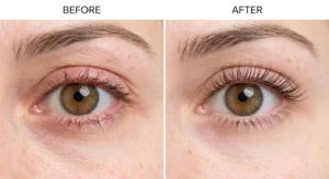 Healthy eyelashes before and after proper eyelid hygiene 