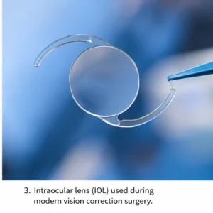 Close-up of a premium intraocular lens (IOL) used during modern eye lens replacement surgery for long-term vision correction.
