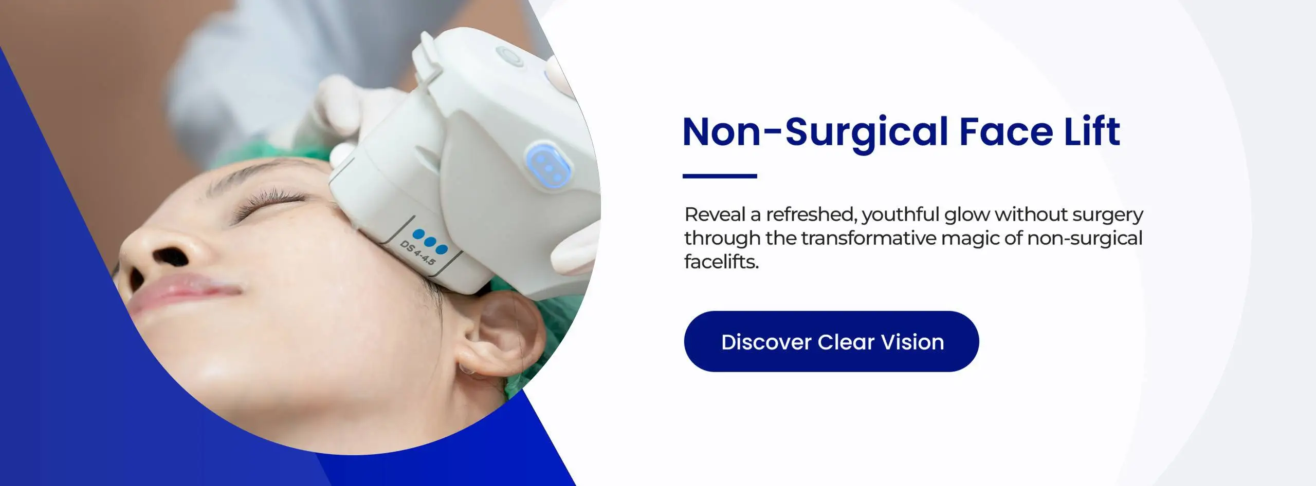 non-surgical-face-lift